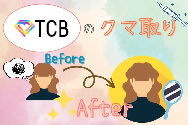 TCB（東京中央美容外科）のクマ取り整形を受けた人のビフォーアフター