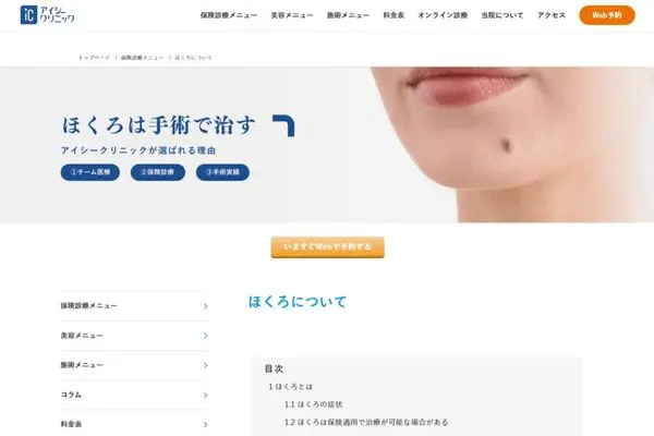 アイシークリニック｜露出していないほくろの除去もできる