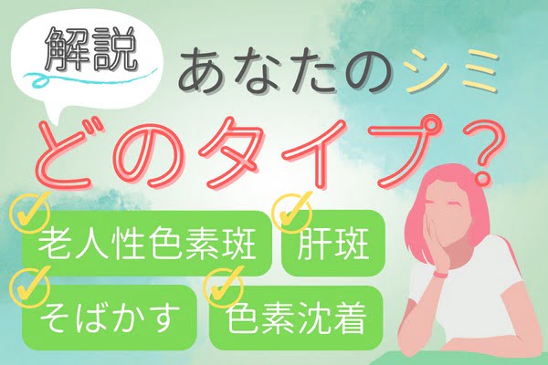 あなたのシミはどのタイプ？シミの種類別の特徴について