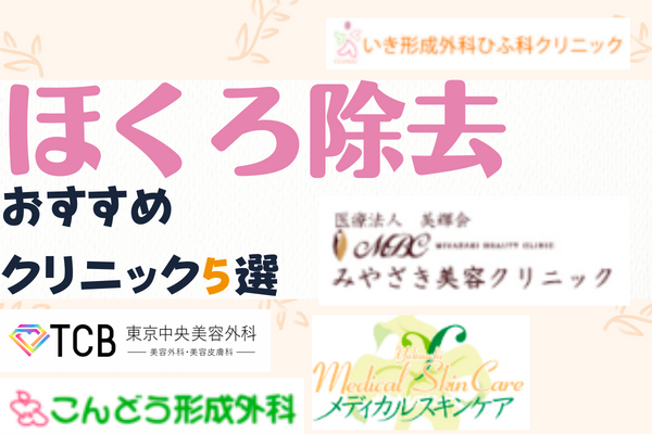 宮崎エリアでほくろ除去ができるおすすめクリニック5選！料金や各院のおすすめポイントを紹介