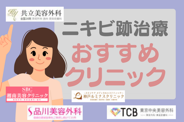 神戸でニキビ跡治療がおすすめの11院｜安い料金＆特徴を紹介