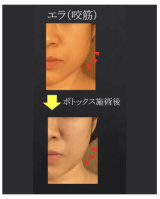 BeautyTuningClinicの症例写真